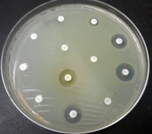 Methicillin-resistant Staphylococcus aureus - Wikipedia